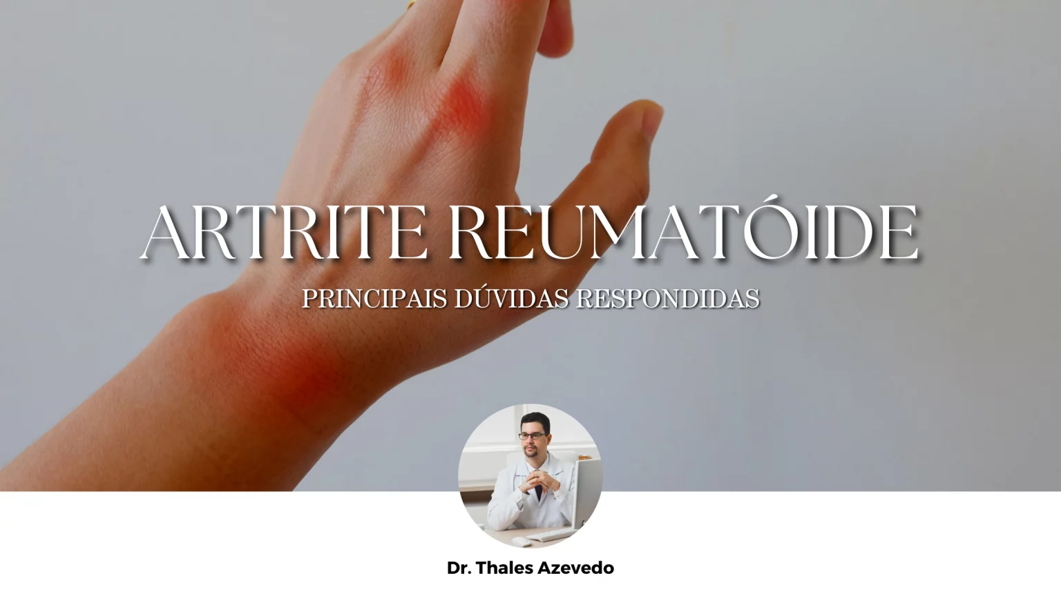 Imagem de Blog. Dr Thales Azevedo Artrite reumatóide principais dúvidas respondidas
